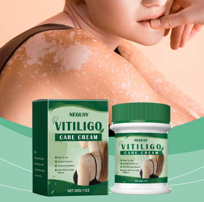🎁Buy 2 Get 1 free——NEGUSY™ Botanical Vitiligo Repair Cream (Stop Hiding Protocol) 🌿