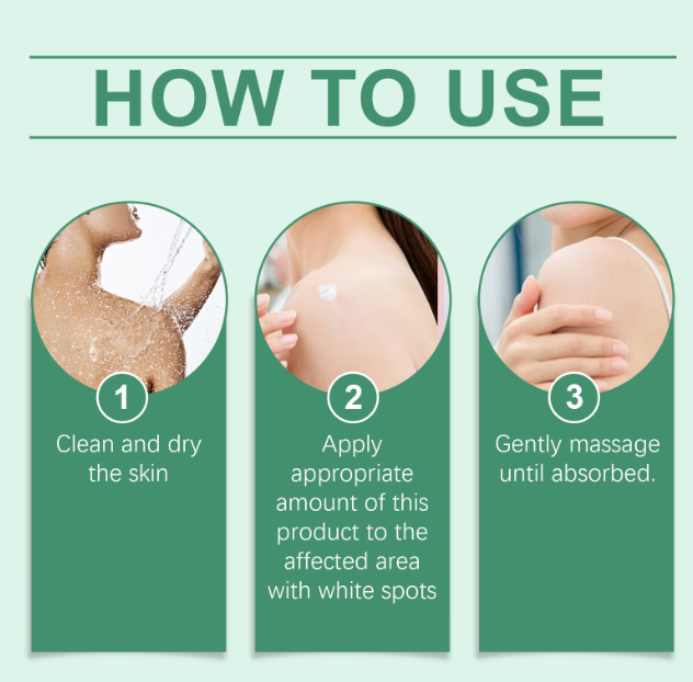🎁Buy 2 Get 1 free——NEGUSY™ Botanical Vitiligo Repair Cream (Stop Hiding Protocol) 🌿